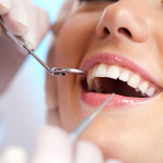 Does Dental Insurance Cover Implants?
